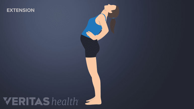 McKenzie method back exercise extension in standing or bending backward.