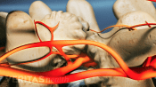 Pain in the medial branch nerves.