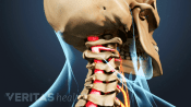 Posterior view of the neck showing the cervical spinal cord.