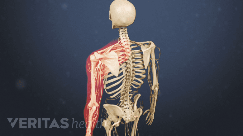 Illustration showing arm highlighted in red.