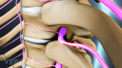 Profile view of nerve root exiting spinal canal in the thoracic spine.