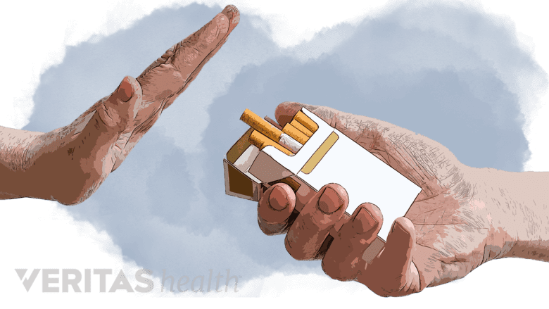 A pack of cigarettes.