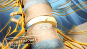 Nucleus pulposus highlighted in the disc between two vertebra