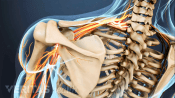 Posterior view of the upper back showing pain radiating in the shoulder
