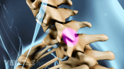 Facet joints highlighted in the cervical spine