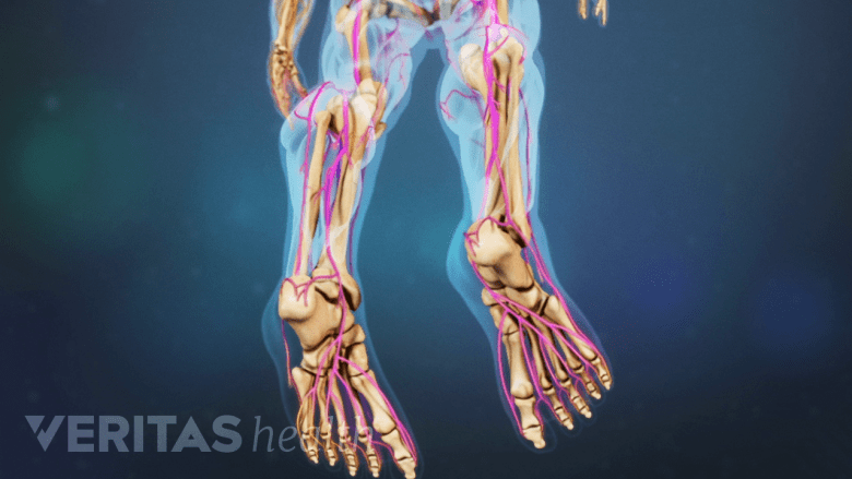 Illustration showing both the feet and calf highlighted in pink.