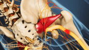 Posterior view of the pelvis showing compression in the sciatic nerve.
