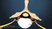 Superior view of a lumbar vertebra with a normal spinal canal.