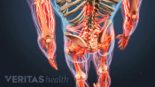 Posterior view of the lower body showing pain radiating in the appendages.