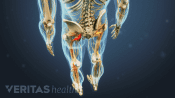 Posterior view of the lower body showing pain radiating down the left leg.