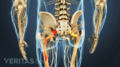 Posterior view of the pelvis showing pain radiating down the left leg.