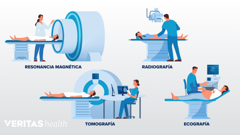 Varios tipos de pruebas de imagen.
