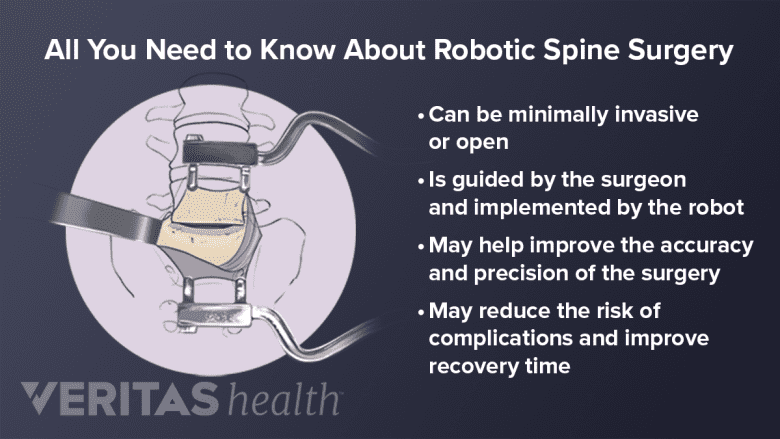 A surgeon performing a surgery with the help of several robotic arms.