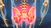 Posterior view showing pain and stiffness in the low back