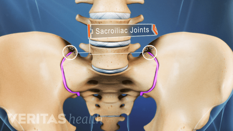 Anterior view of the pelvis highlighting the sacroiliac joints on both sides.