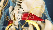 Anatomy of the piriformis muscle and the symptoms of piriforms syndrome.