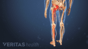 Medical illustration of the torso and upper legs. The sciatic nerve is highlighted in red