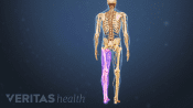 Posterior view of the lower body showing sciatic numbness in the legs.