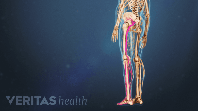 An illustration showing one leg highlighted in pink.