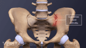 3D rendering of the hip bone of the human skeleton. Highlighting the SI Joint.