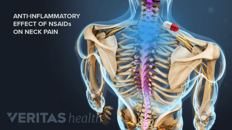 Medical illustration showing adult spine with the neck area highlighted in blue.