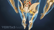 Posterior view of the lower body showing sciatic pain in the legs.