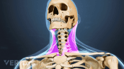 Medical illustration of the upper body and neck. The sternocleidomastoid muscle is highlighted in pink