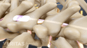 Posterior view of the spine showing the spinal cord stimulation path.