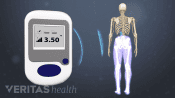 Controller sending pain control signals for lower back pain to generator implanted in the body during spinal cord stimulation