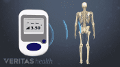 Wireless siganls transmitted from a spinal cord stimulator to the body.