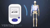 Spinal Cord Stimulator controller emitting signals to reduce upper back pain
