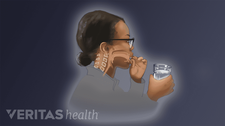 Illustration showing a woman swallowing a pill.