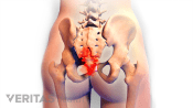 Posterior view of the skeletal system at the pelvis showing pain in the tailbone.