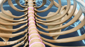 location of a thoracic herniated disc