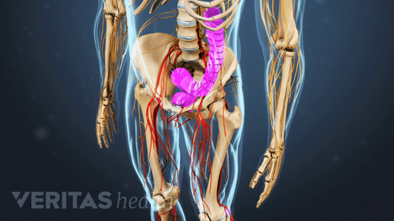Illustration showing the pelvis with bowel highlighted in pink.