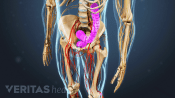 Anterior view from chest to knees showing myelopathy.