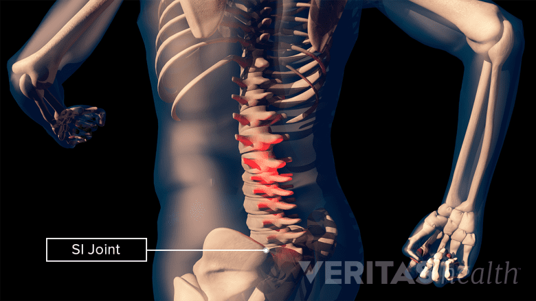3D illustration of the lower spine and pelvis.