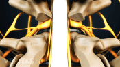 Spinal cord and nerves showing trimmed facet joints.
