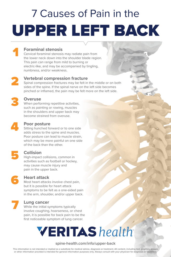 7 Causes of Pain in the Upper Left Back