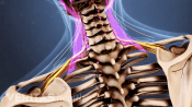 Medical illustration of the head and upper back. Muscles and nerves in the neck and upper shoulders are highlighted.
