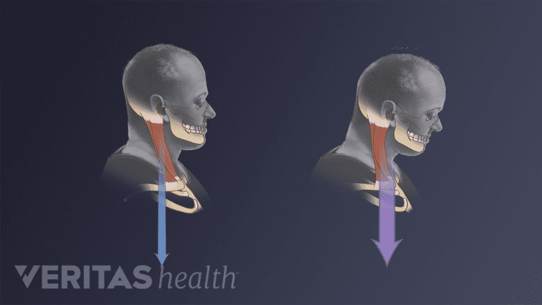 Pproper head posture and forward head posture