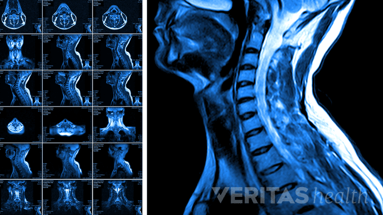 MRI scan of head and neck.