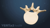 Superior view of a vertebra.
