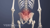 Posterior view of vertebrogenic pain in the low back.