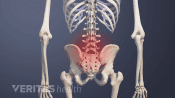 Posterior view of vertebrogenic pain in the low back.