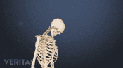 Profile of head forward from impact that causes whiplash